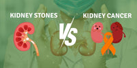 Kidney Stones vs. Kidney Cancer