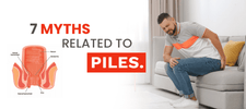 Myths related to Piles/Hemorrhoids you should know