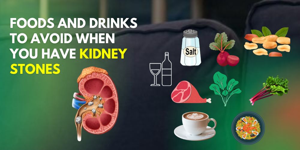 Foods & Drinks to avoid with kidney stones