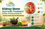 Kidney Stone Ayurvedic Treatment by Size: A Practical Guide for 4 mm, 8 mm and 12 mm Stones