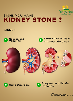 Kidney stone treatment 
