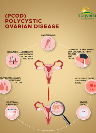 Pcos treatment in Ayurveda