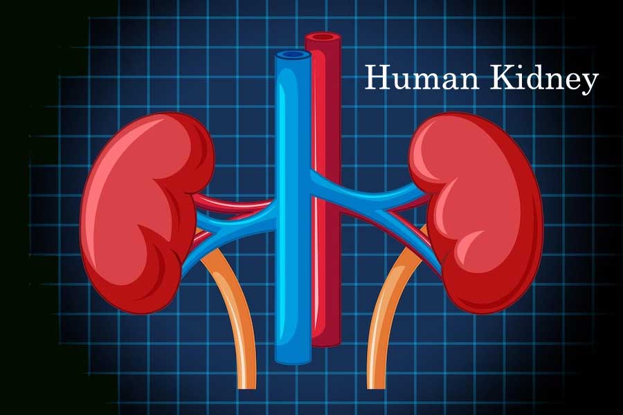 Kidney Stones : Symptoms, Causes, Diagnosis, Remedies