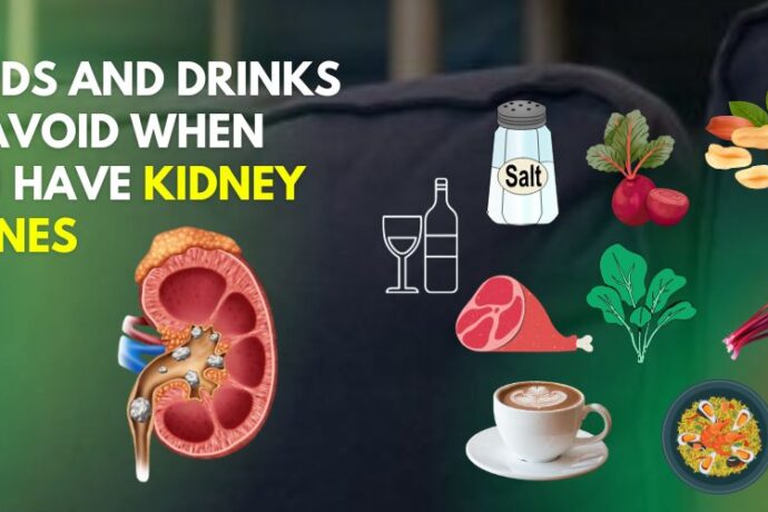 Foods and Drinks to Avoid with Kidney Stones