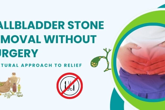 gallbladder stone removal without surgery